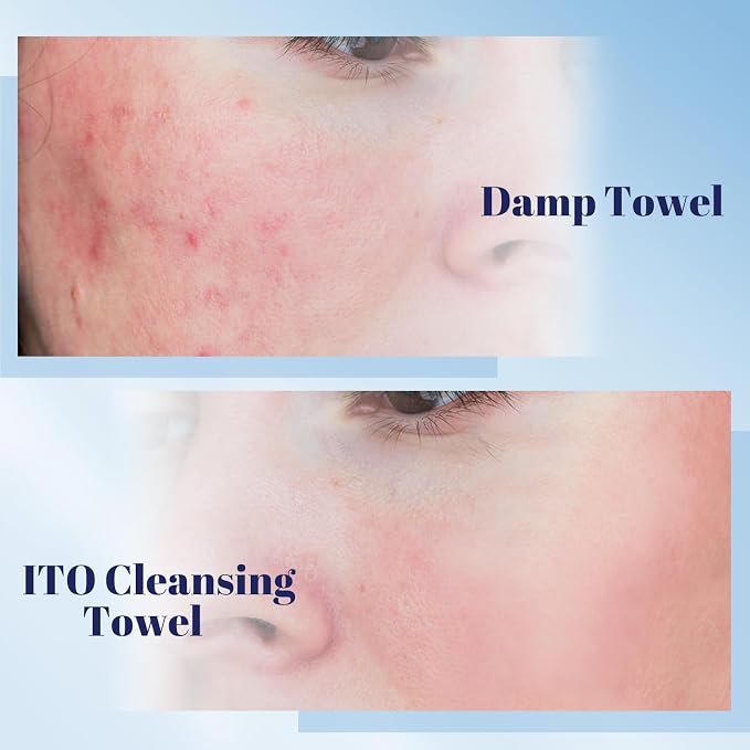 ITO Disposable Face Towel, Ultra-Soft 1-Second Quick-Dry Face Towels, Gentle - Image 6