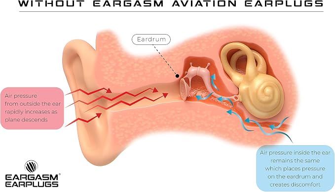 Eargasm Aviation Earplugs - Image 6