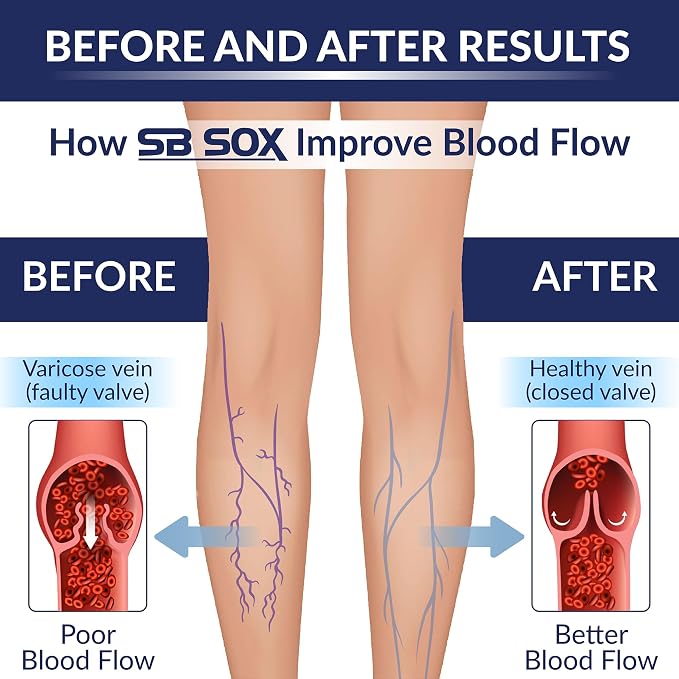 SB SOX Compression Socks for Men & Women - Image 3