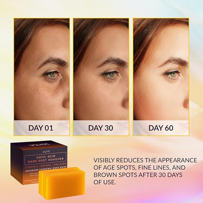 VALITIC Kojic Acid Dark Spot Remover Soap Bar - Image 2