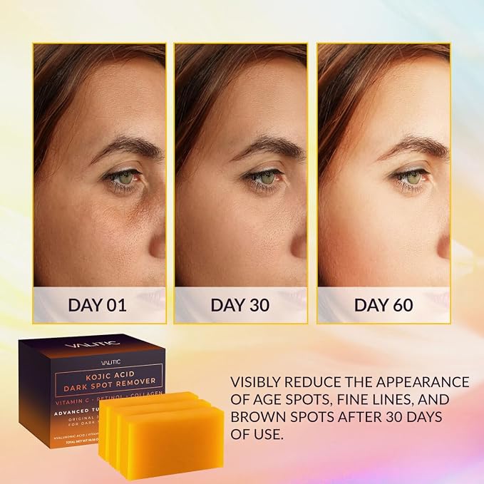 VALITIC Kojic Acid Dark Spot Remover Soap Bars - Image 2
