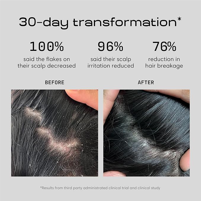 Jupiter Anti Dandruff Shampoo, for Women & Men, Physician-Formulated for Flaky - Image 3