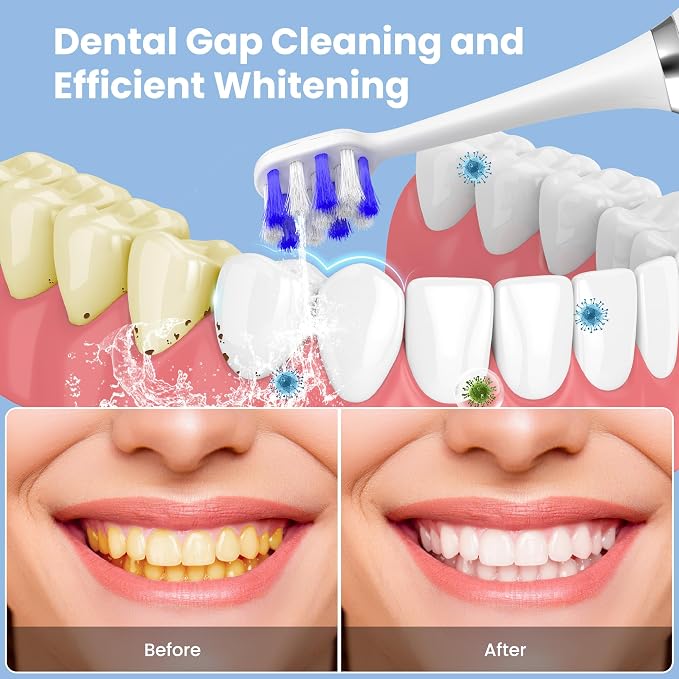 Portable Water flosser with Electric Toothbrush, 2 in 1 Teeth Cleaning Kit - Image 2